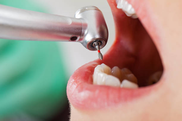 Best Emergency Tooth Extraction in Selmont West Selmont, AL